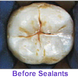 Seal Out Decay - Before Sealants