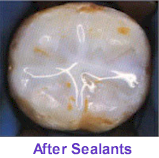 Seal Out Decay - After Sealants