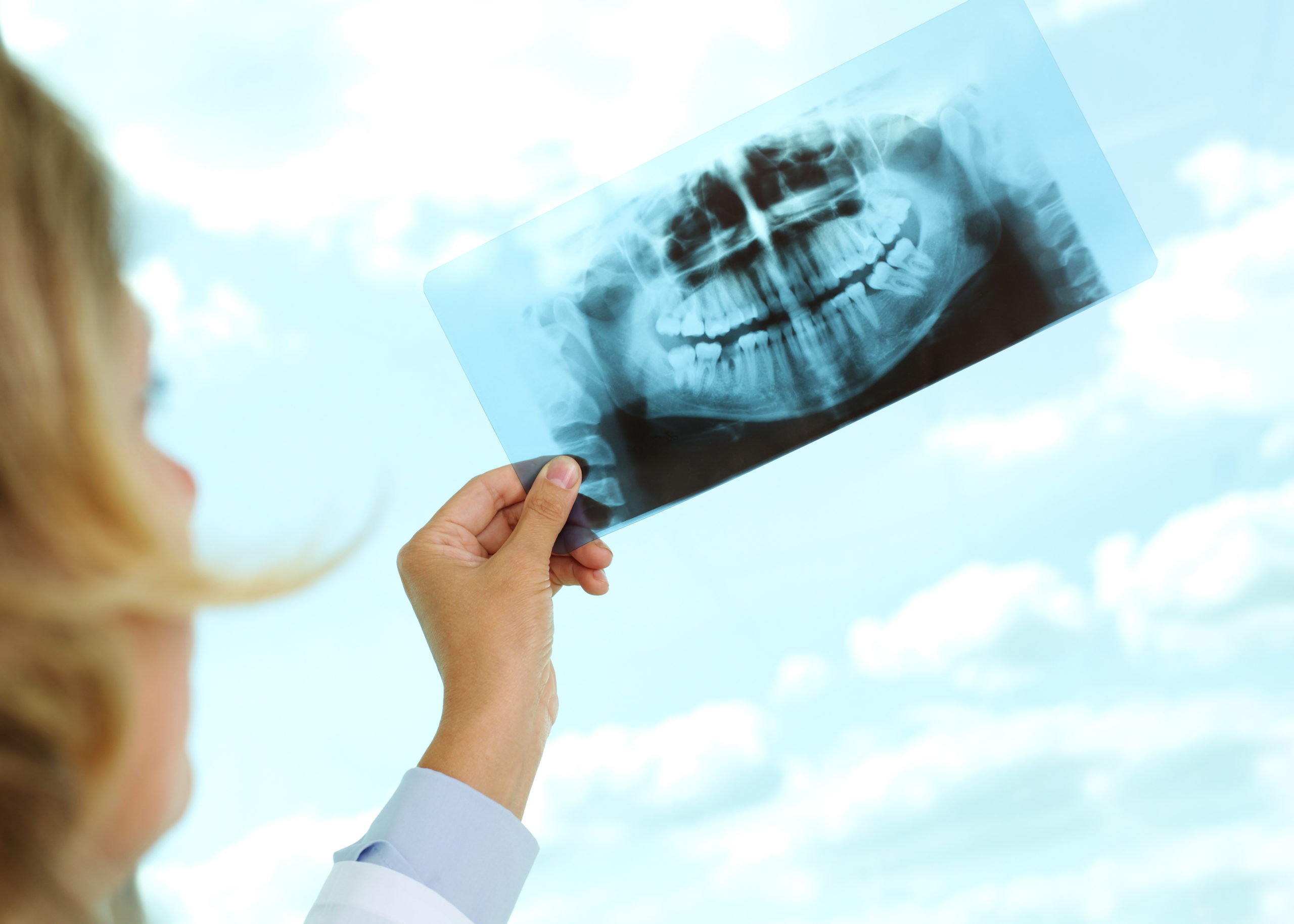 Why Are Dental XRays Important?